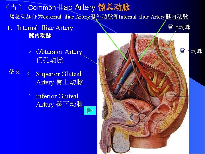 （五） Common Iliac Artery 髂总动脉分为external iliac Artery髂外动脉和Internal iliac Artery髂内动脉 1、 Internal Iliac 髂内动脉 Artery