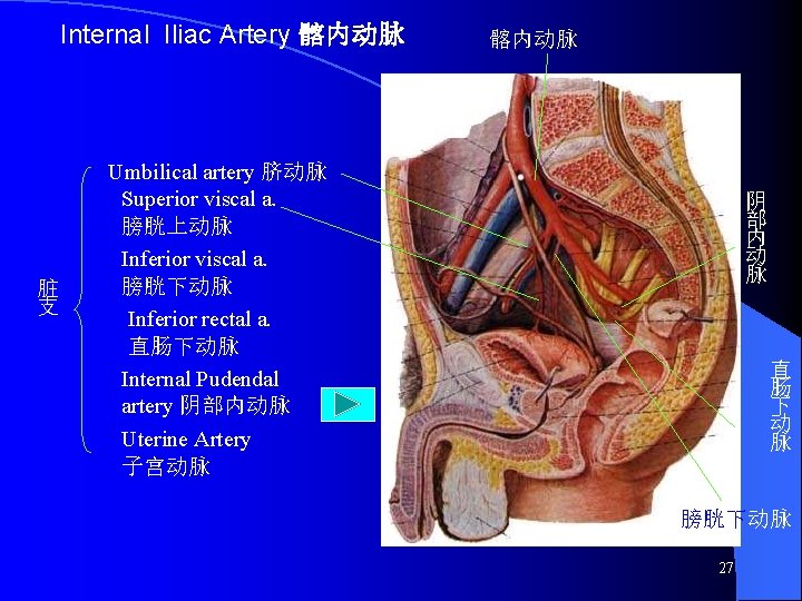 Internal Iliac Artery 髂内动脉 Umbilical artery 脐动脉 Superior viscal a. 脏支 膀胱上动脉 Inferior viscal