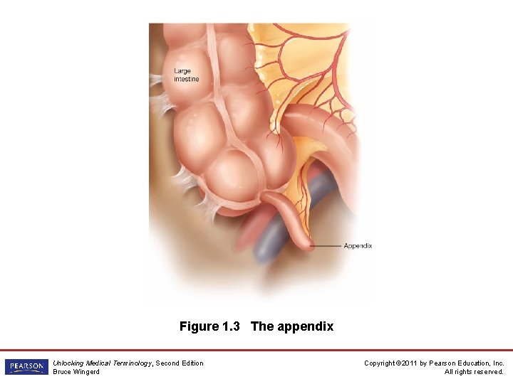 Figure 1. 3 The appendix Unlocking Medical Terminology, Second Edition Bruce Wingerd Copyright ©