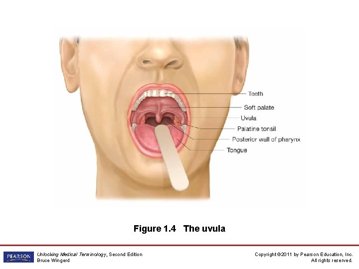 Figure 1. 4 The uvula Unlocking Medical Terminology, Second Edition Bruce Wingerd Copyright ©