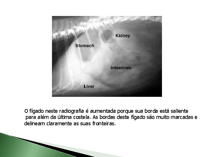 O fígado neste radiografia é aumentada porque sua borda está saliente para além da