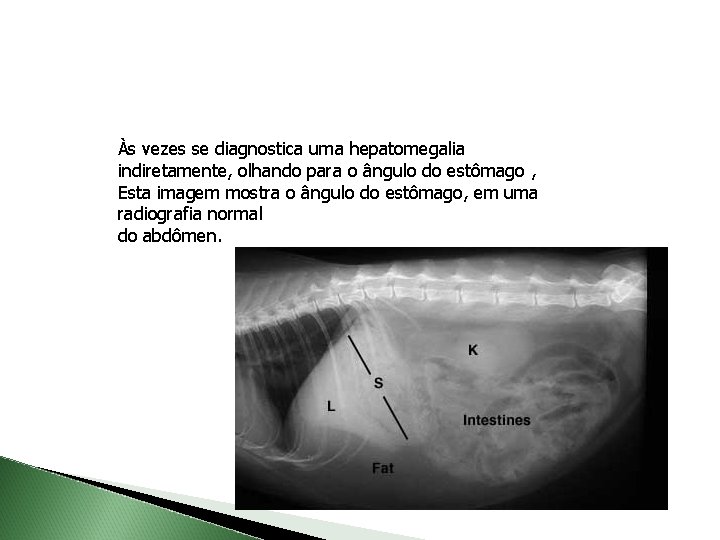 Às vezes se diagnostica uma hepatomegalia indiretamente, olhando para o ângulo do estômago ,