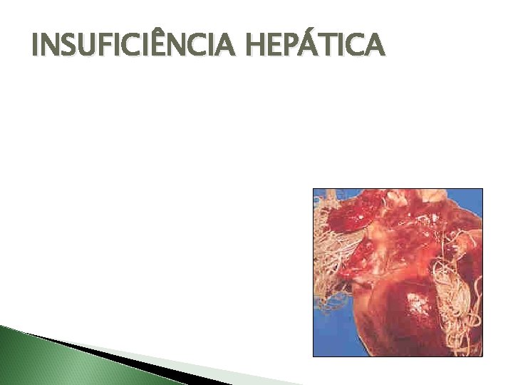 INSUFICIÊNCIA HEPÁTICA 