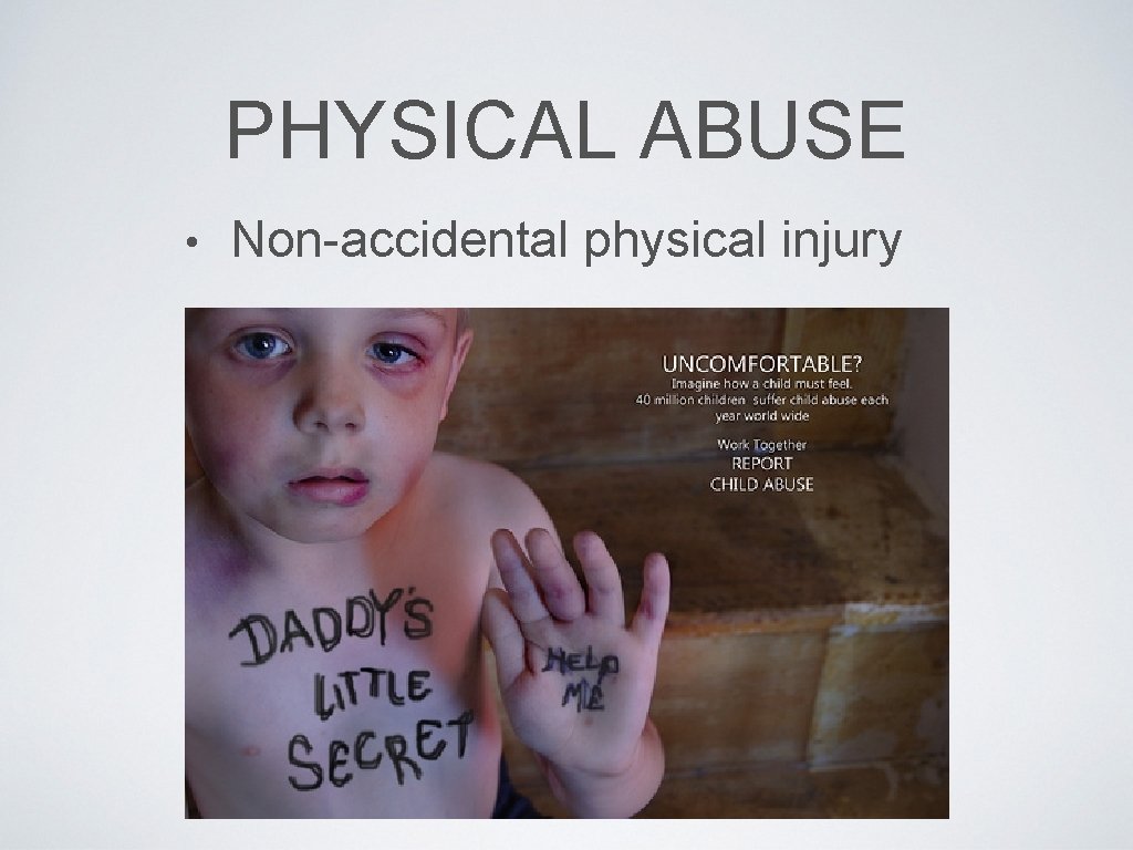 PHYSICAL ABUSE • Non-accidental physical injury 