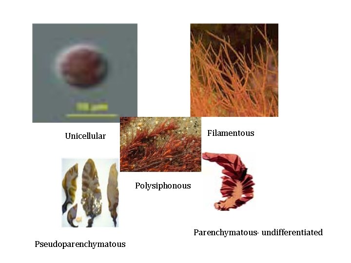 Filamentous Unicellular Polysiphonous Parenchymatous- undifferentiated Pseudoparenchymatous 