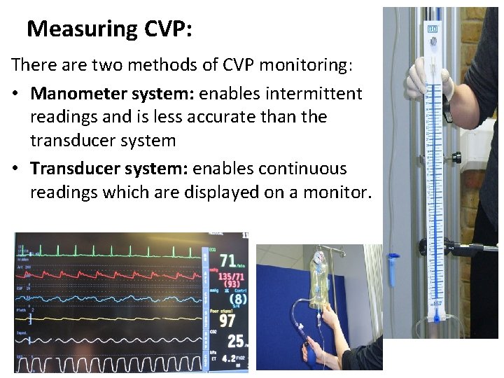 Measuring CVP: There are two methods of CVP monitoring: • Manometer system: enables intermittent