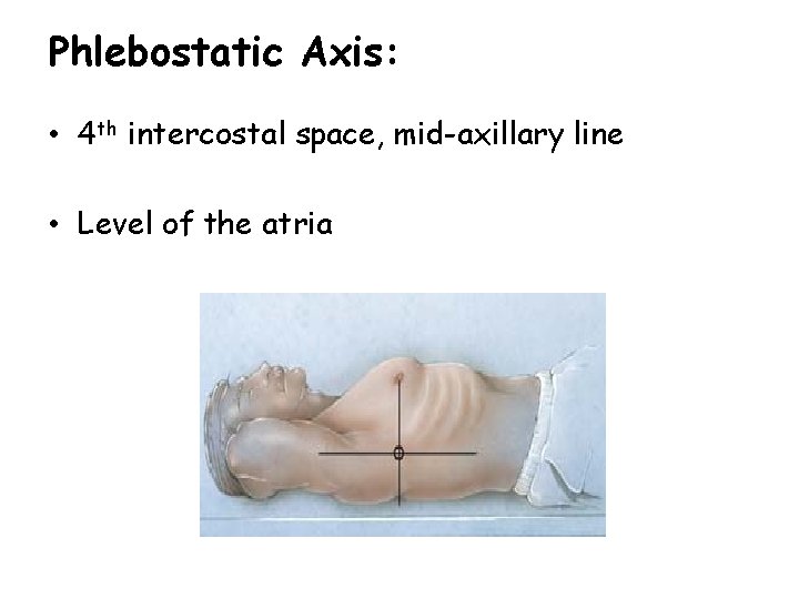 Phlebostatic Axis: • 4 th intercostal space, mid-axillary line • Level of the atria