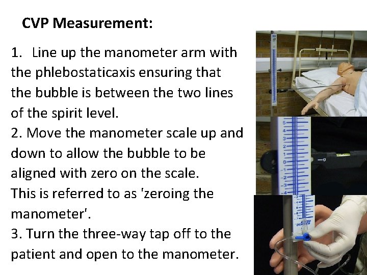 CVP Measurement: 1. Line up the manometer arm with the phlebostaticaxis ensuring that the