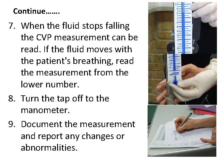 Continue……. 7. When the fluid stops falling the CVP measurement can be read. If