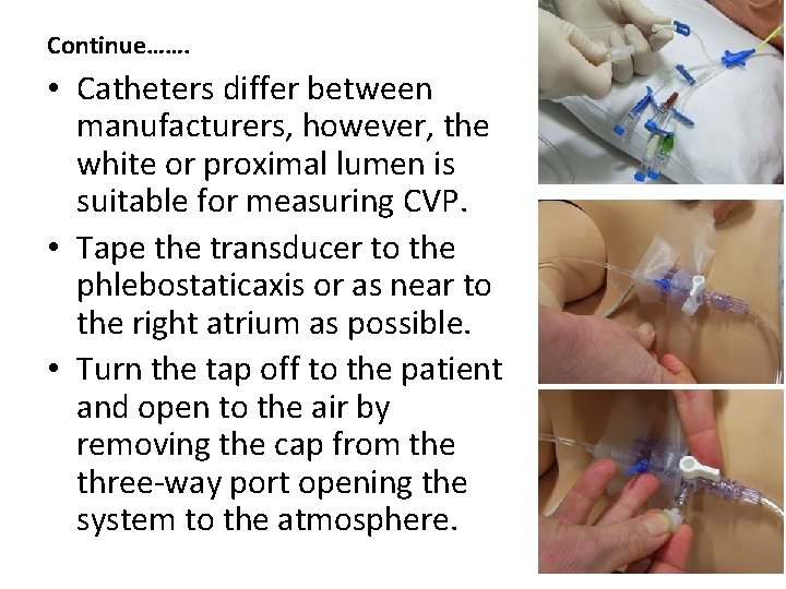 Continue……. • Catheters differ between manufacturers, however, the white or proximal lumen is suitable Continue……. • Catheters differ between manufacturers, however, the white or proximal lumen is suitable