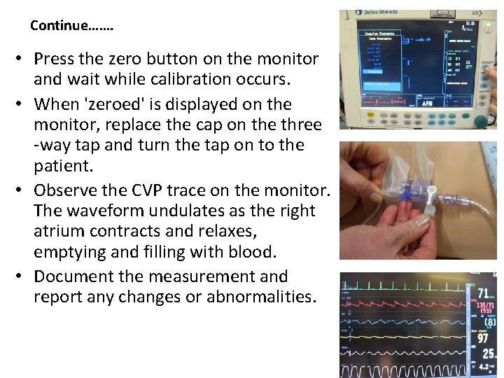 Continue……. • Press the zero button on the monitor and wait while calibration occurs.