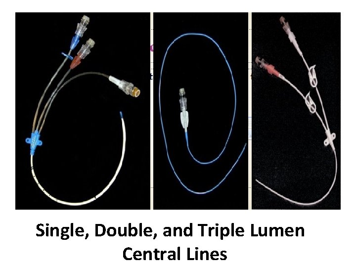 Single, Double, and Triple Lumen Central Lines 