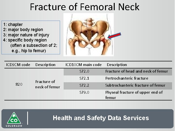 Fracture of Femoral Neck 1: chapter 2: major body region 3: major nature of