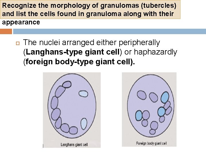 Recognize the morphology of granulomas (tubercles) and list the cells found in granuloma along