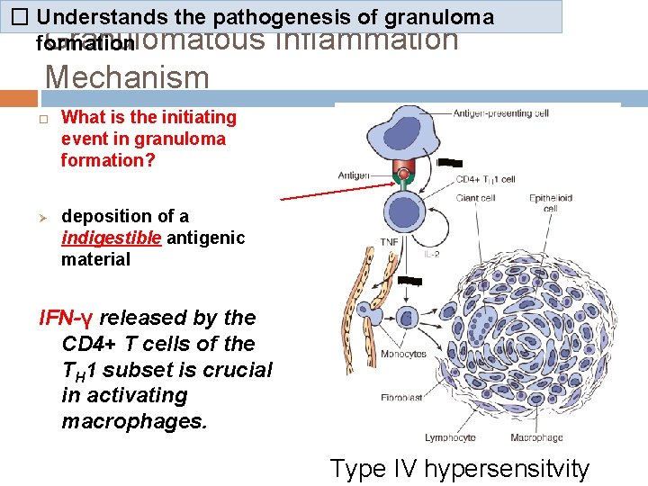 � Understands the pathogenesis of granuloma Granulomatous Inflammation formation Mechanism Ø What is the