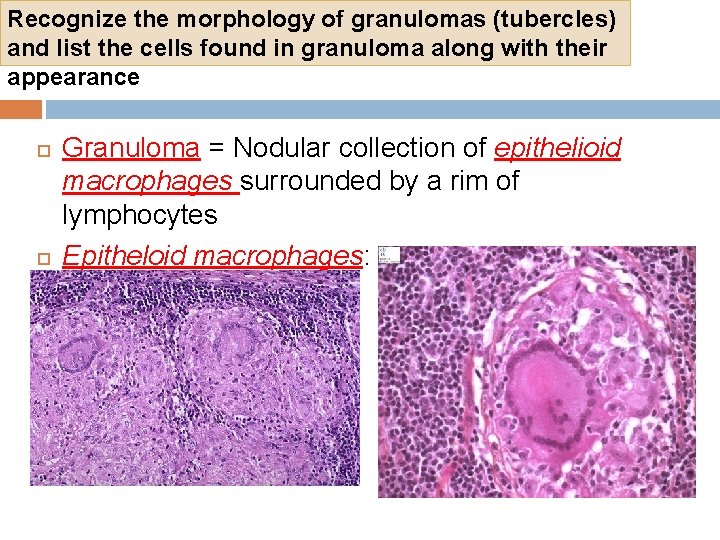 Recognize the morphology of granulomas (tubercles) and list the cells found in granuloma along Recognize the morphology of granulomas (tubercles) and list the cells found in granuloma along