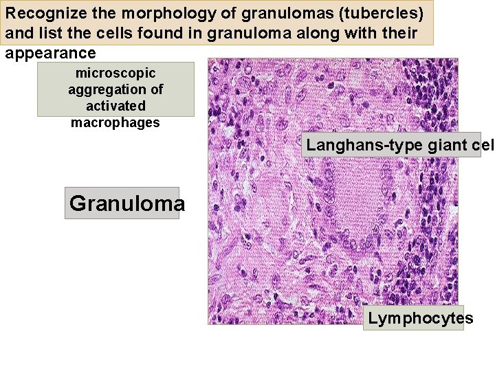 Recognize the morphology of granulomas (tubercles) and list the cells found in granuloma along