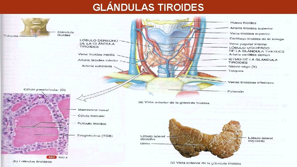GLÁNDULAS TIROIDES GLÁNDULAS TIROIDES