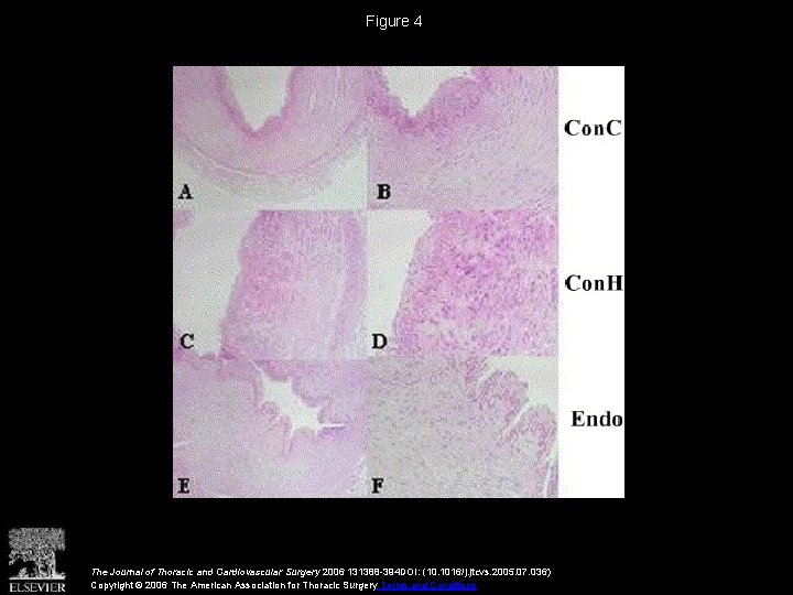 Figure 4 The Journal of Thoracic and Cardiovascular Surgery 2006 131388 -394 DOI: (10.
