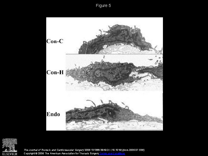 Figure 5 The Journal of Thoracic and Cardiovascular Surgery 2006 131388 -394 DOI: (10.