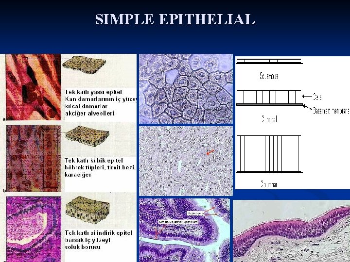 SIMPLE EPITHELIAL 