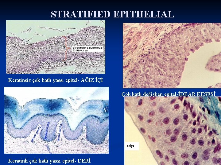 STRATIFIED EPITHELIAL Keratinsiz çok katlı yassı epitel AĞIZ İÇİ Çok katlı değişken epitel İDRAR