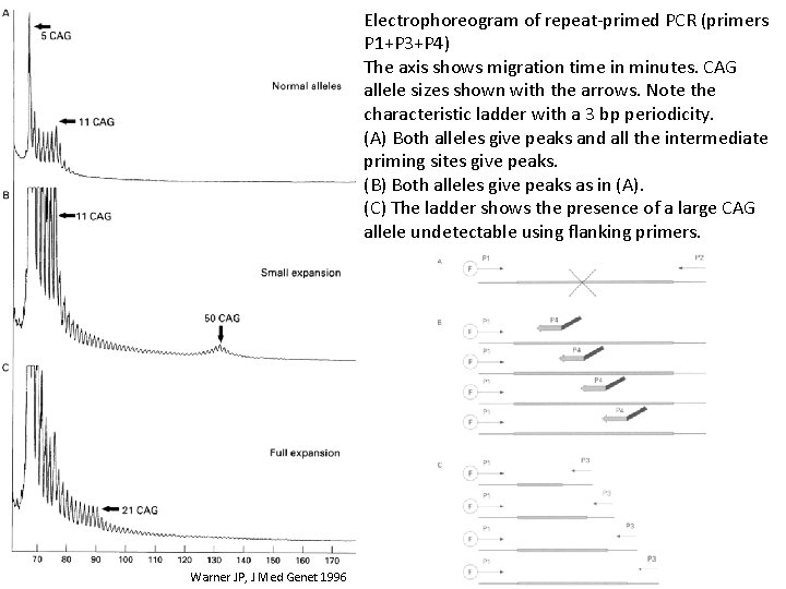 Electrophoreogram of repeat-primed PCR (primers P 1+P 3+P 4) The axis shows migration time