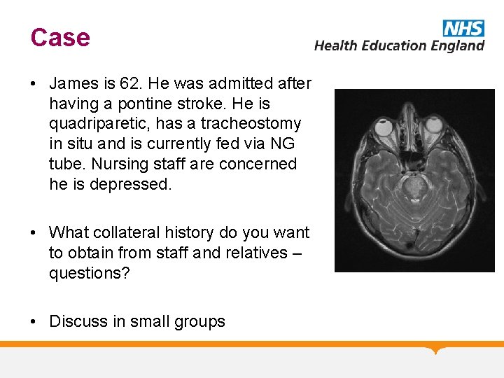 Case • James is 62. He was admitted after having a pontine stroke. He