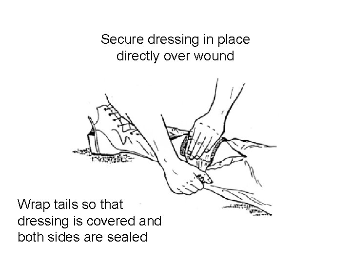 Secure dressing in place directly over wound Wrap tails so that dressing is covered