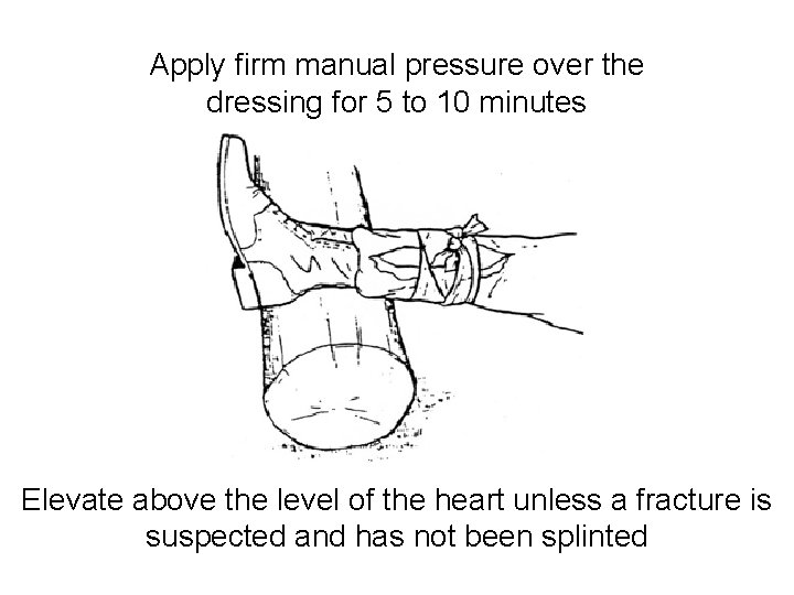 Apply firm manual pressure over the dressing for 5 to 10 minutes Elevate above