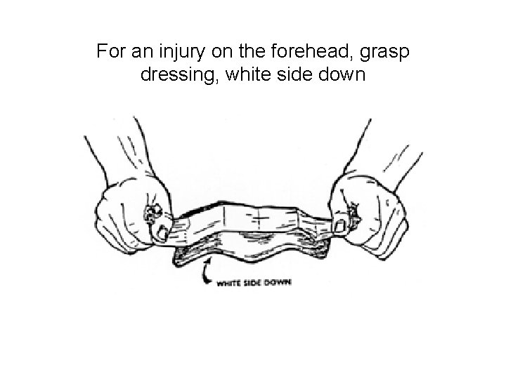 For an injury on the forehead, grasp dressing, white side down 