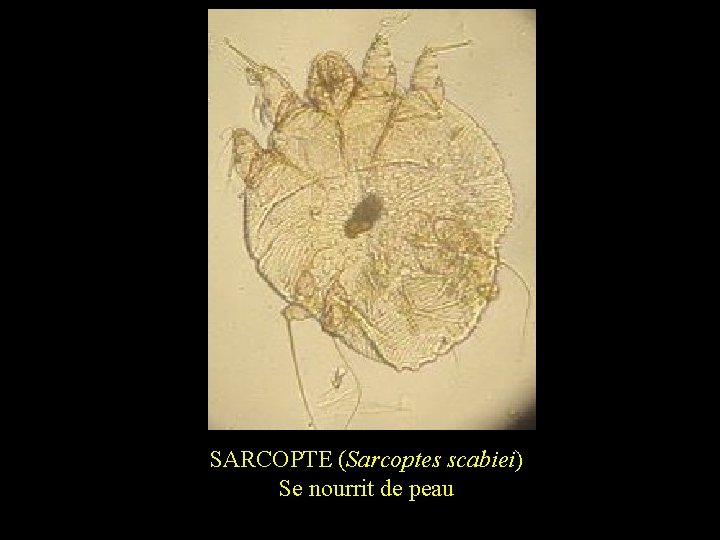 SARCOPTE (Sarcoptes scabiei) Se nourrit de peau 