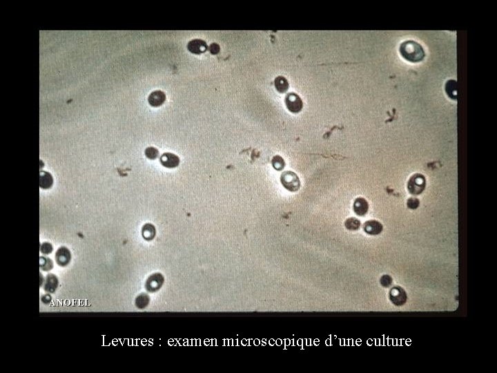 Levures : examen microscopique d’une culture 