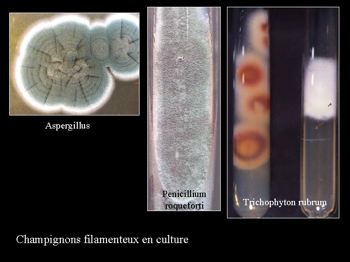 Aspergillus Penicillium roqueforti Champignons filamenteux en culture Trichophyton rubrum 
