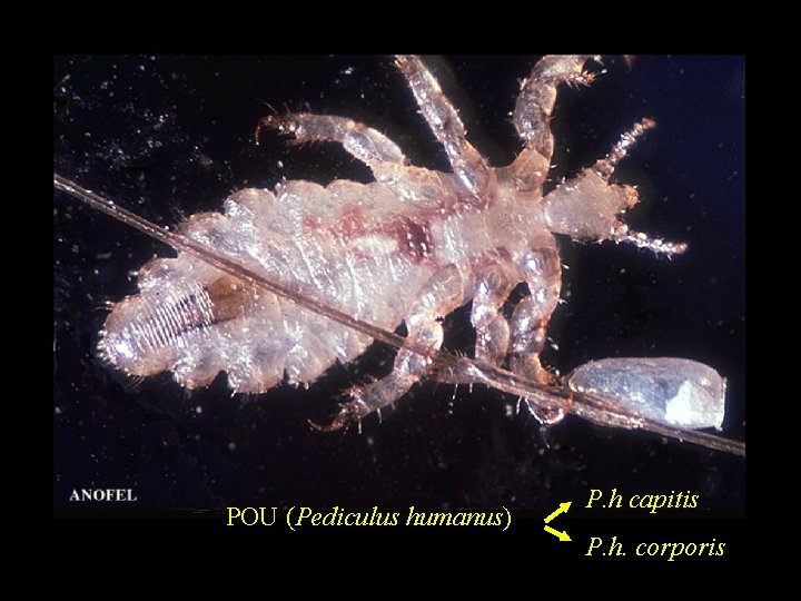 POU (Pediculus humanus) P. h capitis P. h. corporis 
