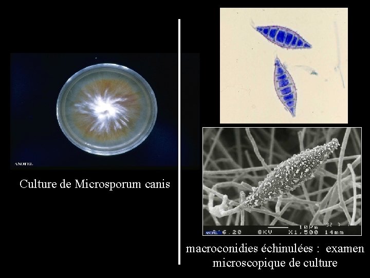 Culture de Microsporum canis macroconidies échinulées : examen microscopique de culture 