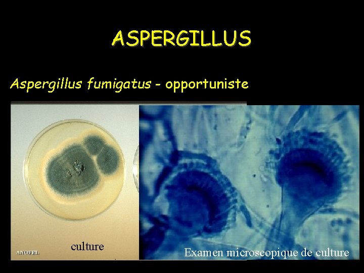 ASPERGILLUS Aspergillus fumigatus - opportuniste culture Examen microscopique de culture 