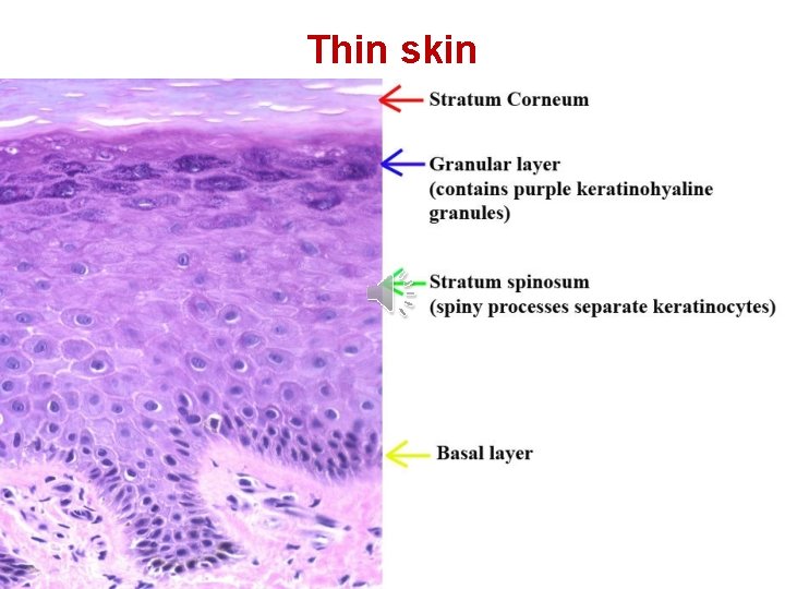 Thin skin Thin skin