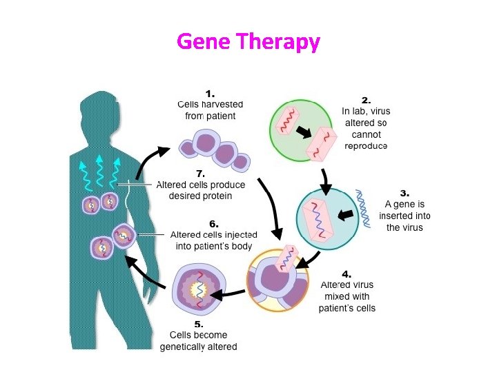 Gene Therapy Gene Therapy