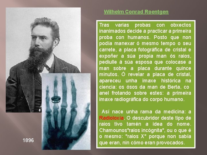 Wilhelm Conrad Roentgen Tras varias probas con obxectos inanimados decide a practicar a primeira