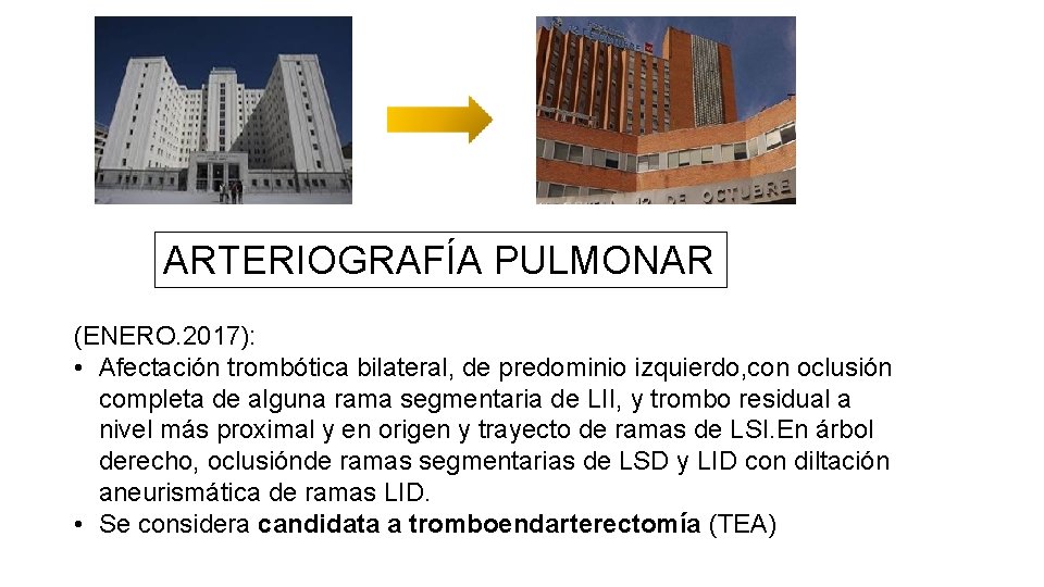 ARTERIOGRAFÍA PULMONAR (ENERO. 2017): • Afectación trombótica bilateral, de predominio izquierdo, con oclusión completa