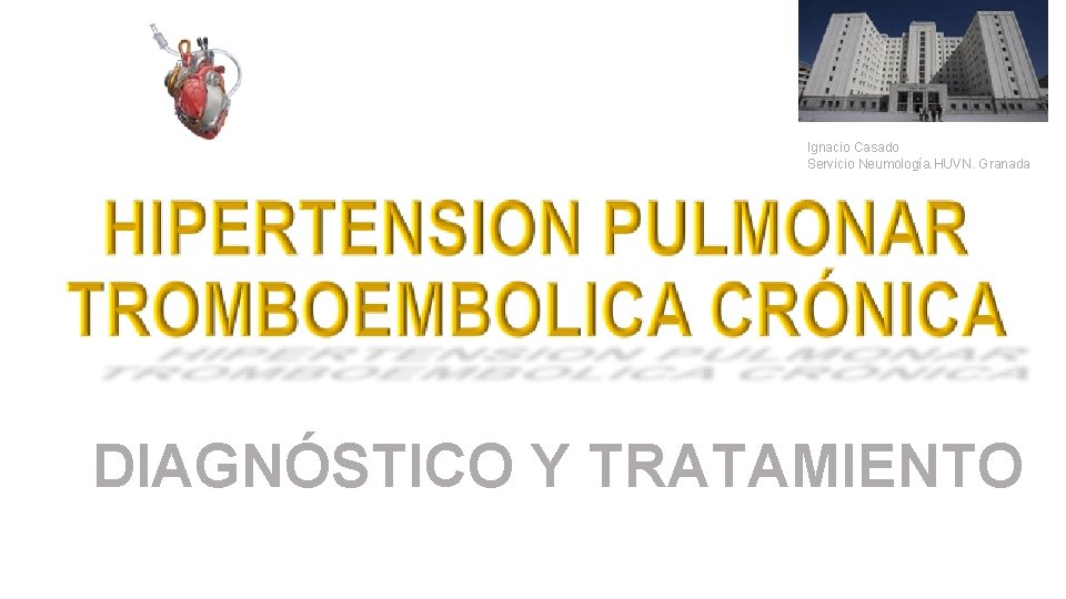 Ignacio Casado Servicio Neumología. HUVN. Granada DIAGNÓSTICO Y TRATAMIENTO 