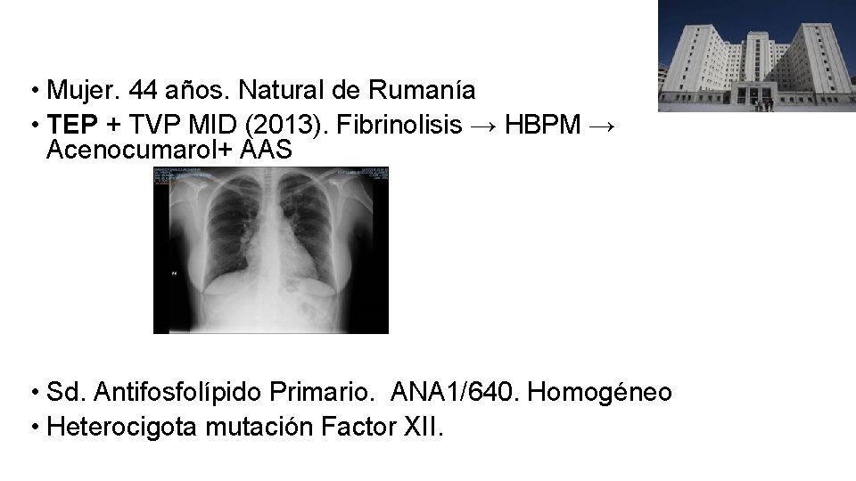  • Mujer. 44 años. Natural de Rumanía • TEP + TVP MID (2013).