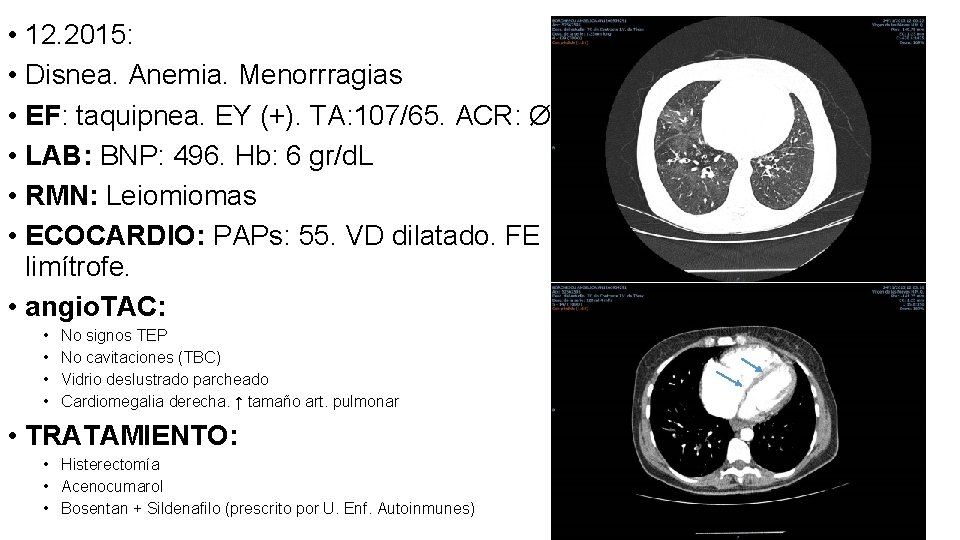  • 12. 2015: • Disnea. Anemia. Menorrragias • EF: taquipnea. EY (+). TA: