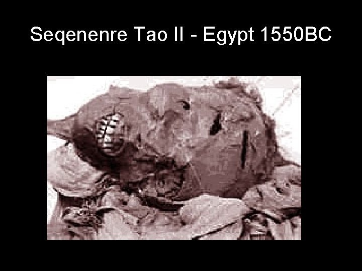 Seqenenre Tao II - Egypt 1550 BC 