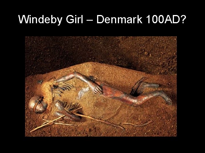Windeby Girl – Denmark 100 AD? 