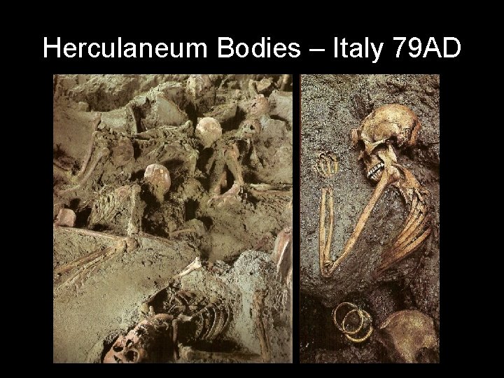 Herculaneum Bodies – Italy 79 AD 