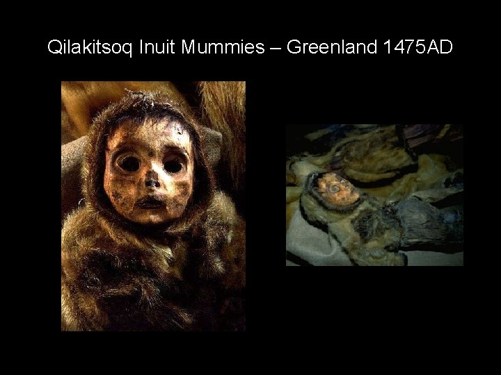 Qilakitsoq Inuit Mummies – Greenland 1475 AD 