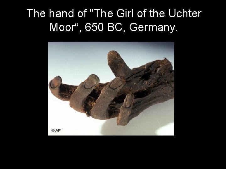 The hand of "The Girl of the Uchter Moor“, 650 BC, Germany. 