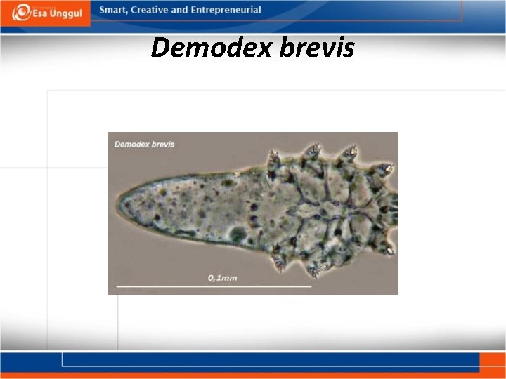 Demodex brevis 